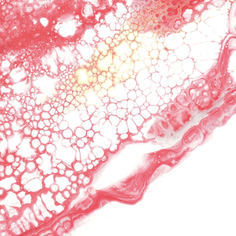 ink-on-paper-haematological-representation
